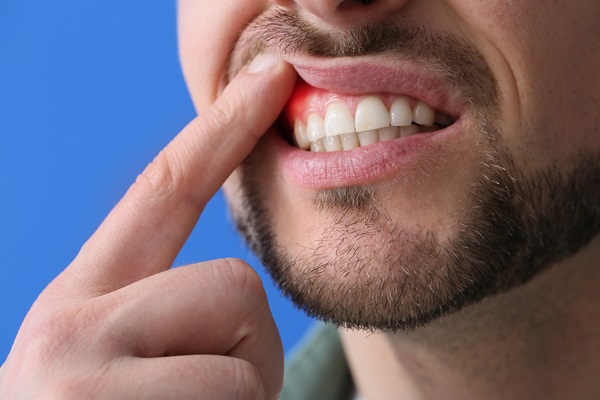 What Is Periodontics?