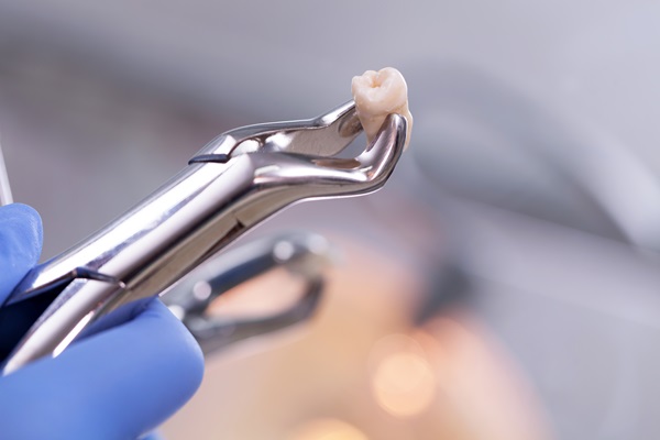 Why You Should Rest After A Tooth Extraction